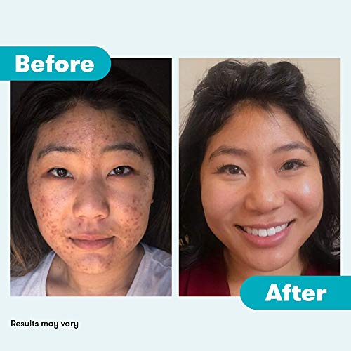 Acne-fighting Deep Cleansing Body Wash 16oz for Clear Skin - Image 10