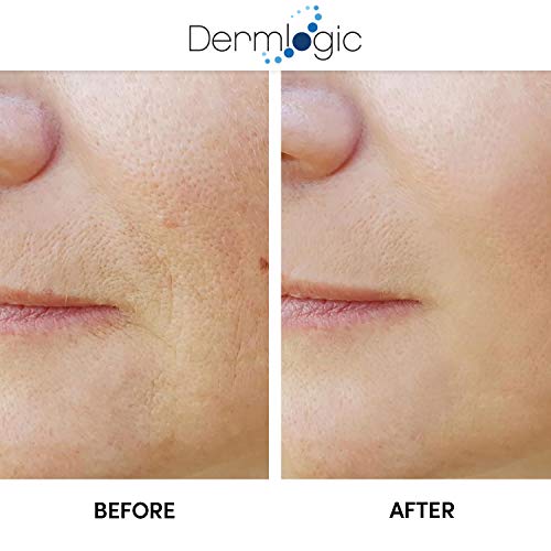 ?Akina Skin Peel: Magic Treatment? - Image 5