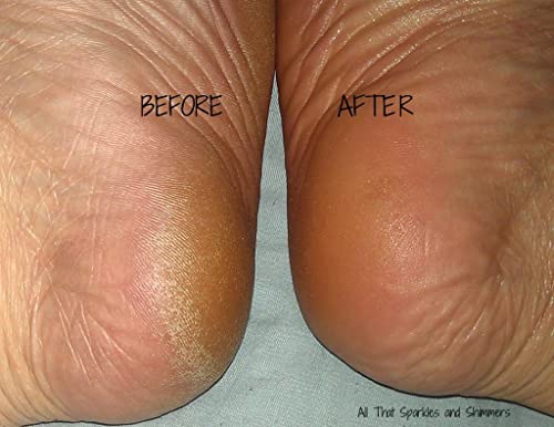 ?Amlactin Ultra Hydrating Body Cream? - Image 7