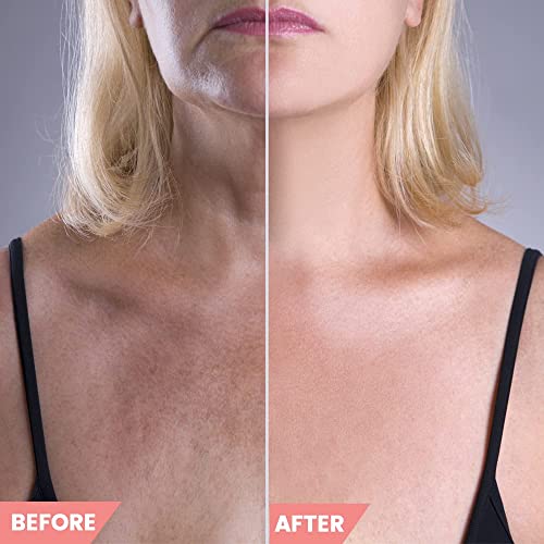 Reusable Anti-Wrinkle Gel Pads for Nighttime Sleep to Reduce Facial Lines - Image 5