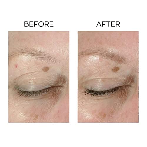 ?Anti Wrinkle Plumping Concentrate? - Image 3