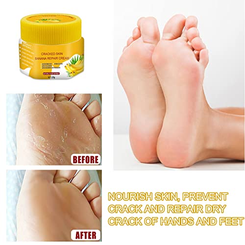 Assure Foot Cream: Proper Usage Guide - Image 3