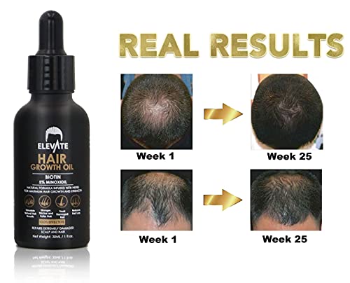 ?Black Castor Oil Causes Scalp Itching? - Image 3