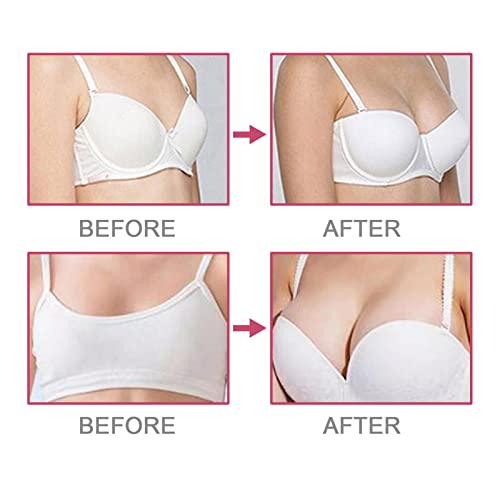 Brisbane Anti Wrinkle Treatment - Image 4