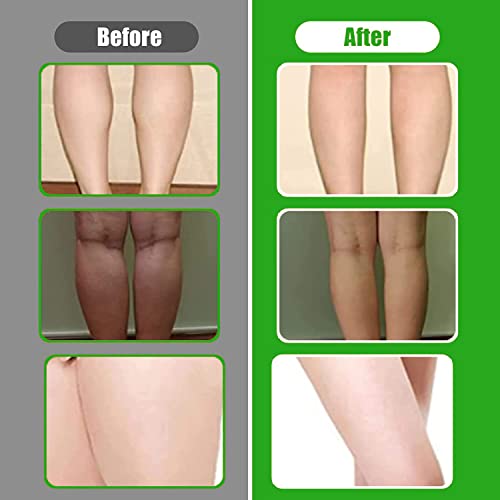 Natural Foot Cream for Silky Smooth, Soft Feet 100ml - Image 7
