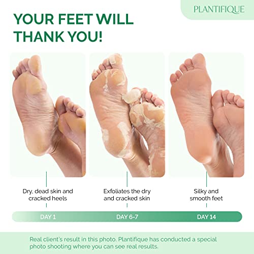 Natural Foot Exfoliating Cream for Soft Smooth Feet 8 oz - Image 2