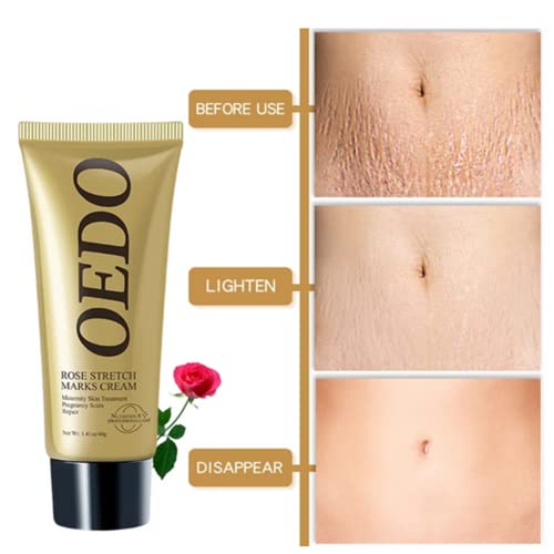 Pregnancy & Anti-Aging Cream 50ml for Expecting Mothers with Essential Information - Image 3