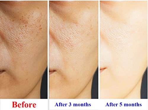 Anti Aging Treatment Serum 1 oz Bottle - Image 6