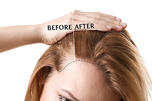 Organic Argan Oil for Skin and Hair, 4 oz Bottle, Cold-Pressed Quality - Image 7