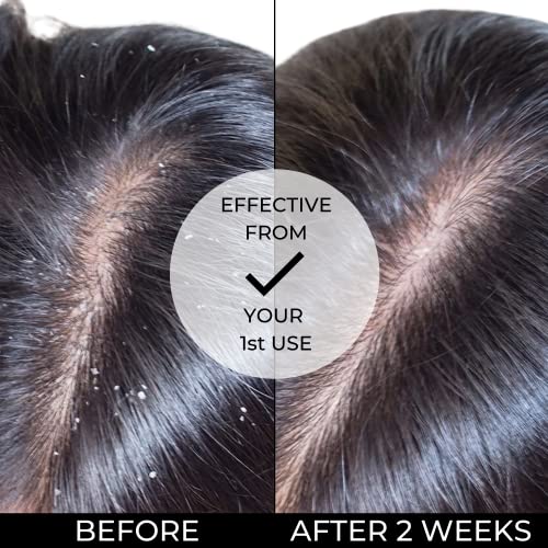 ?Sri Sri Dandruff Shampoo? - Image 7