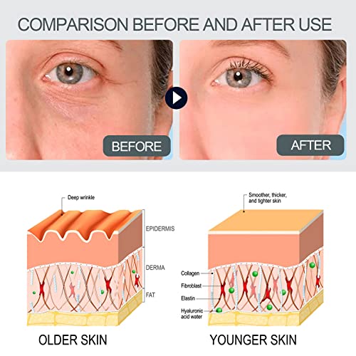 Wrinkle and Acne Cream ? Dual Action Formula - Image 6