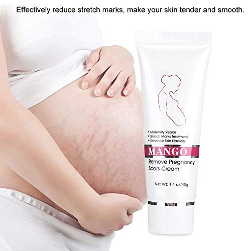Stretch Marks Cream for Babies - Image 4