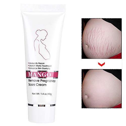Stretch Marks Cream for Babies - Image 2