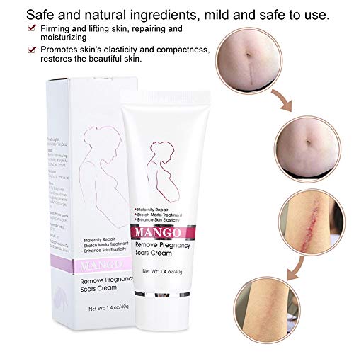 Stretch Marks Cream for Babies - Image 5
