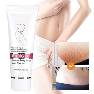 Stretch Marks Cream for Babies