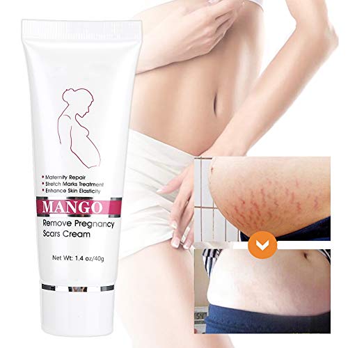 Stretch Marks Cream for Babies