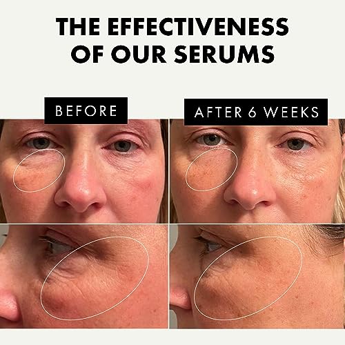 Anti Wrinkle Vitamin C Turmeric Face Serum - Image 3