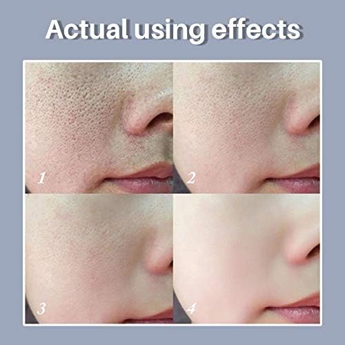 ?Bioderma Anti-Aging Cream: Youthful Skin Solution? - Image 5