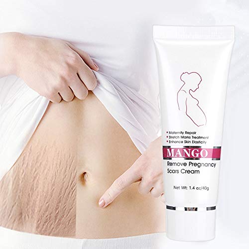 Stretch Marks Cream for Babies - Image 6