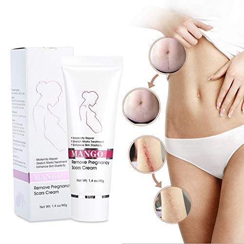 Stretch Marks Cream for Babies - Image 3