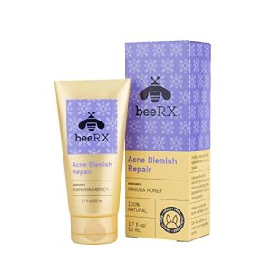 Acne Scar Removal with Skin Peel