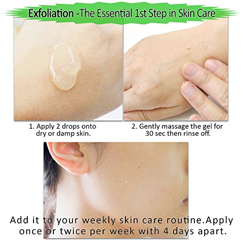 Skin Peel for Dead Skin Removal - Image 4