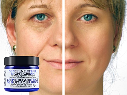 ?Intense Anti-Aging Cream? - Image 4