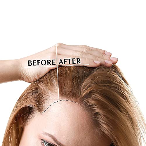 16 oz Coconut Oil for Skin Care Natural Moisturizer May Cause Gentle Peeling - Image 5