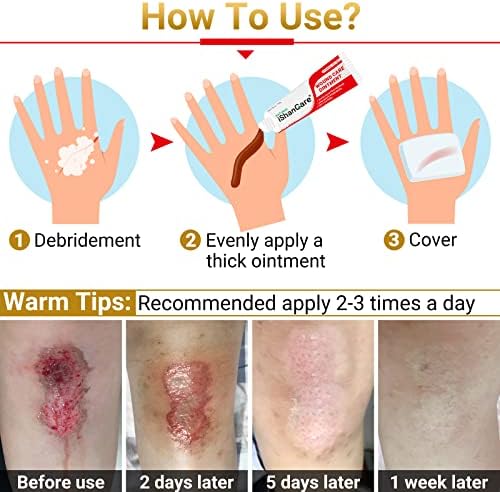 Diabetic Moisturizing Foot Cream Daily Use Healthy Skin Formula 8oz - Image 5