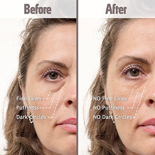 Skinfix Moisturizing Hand Cream for Dry Skin - Image 2