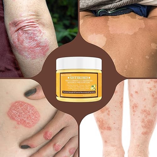 1 oz Tube Corticosteroid Cream for Dry, Irritated Lips Treatment - Image 2