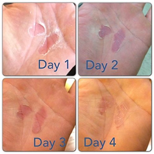 DIY Coconut Oil Hand Cream Recipe - Image 5
