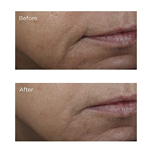 ?Dr Oz?s Powerful Anti Wrinkle Serum? - Image 6