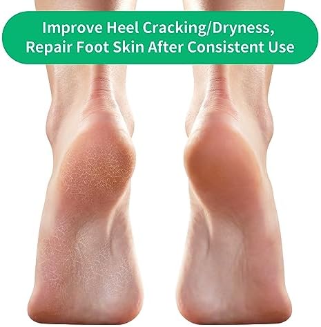 Heel Crack Cream for Smooth Feet - Image 5
