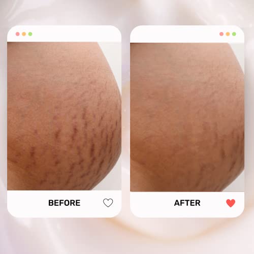 It Works Stretch Mark Moisturizer Body Cream for Visible Improvement - Image 6