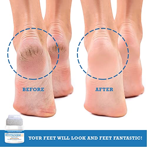 Podiatrist-approved foot cream for healthy, soft feet. - Image 4