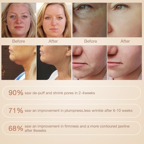 Silk?n Titan Home Anti-Aging Skin Care Device - Image 3