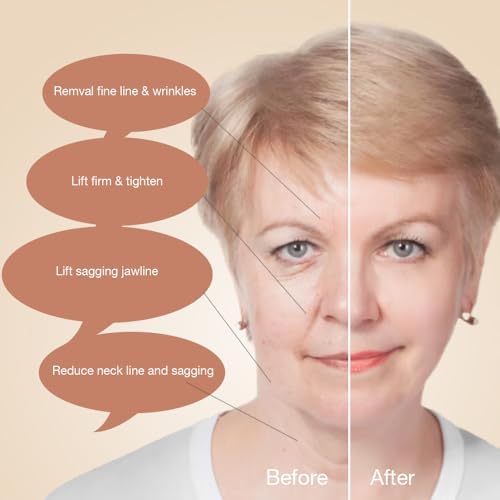 Silk?n Titan Home Anti-Aging Skin Care Device - Image 6