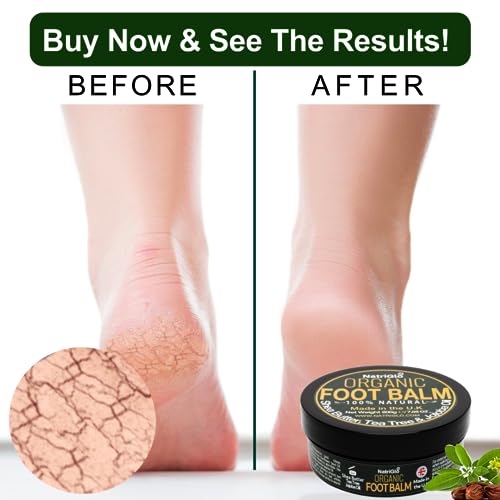 UK Diabetic Foot Cream for Diabetes Management. - Image 4