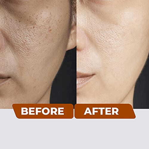 Paraben-Free Sunscreen - Image 5