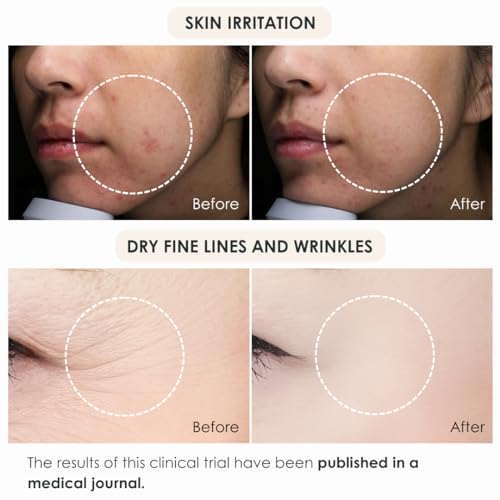 Japanese Skin Peel: Revitalize Your Complexion - Image 4