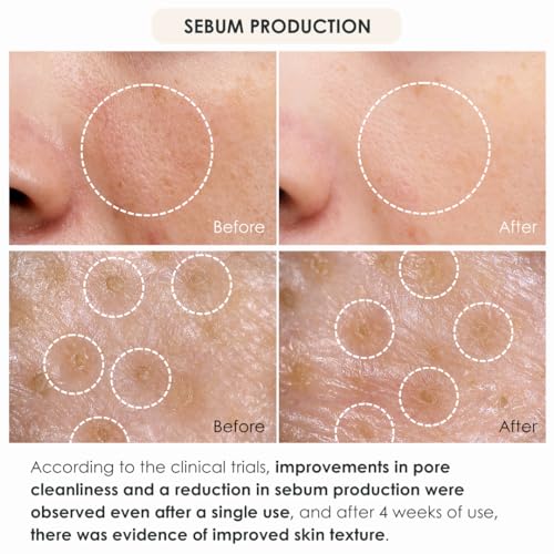 Japanese Skin Peel: Revitalize Your Complexion - Image 3