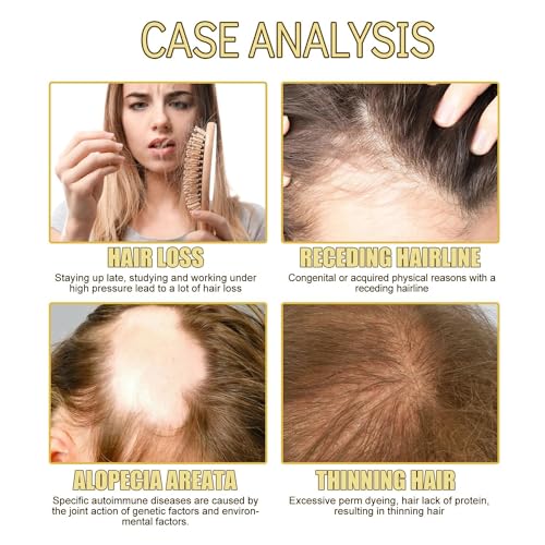 Argan oil for dandruff control - Image 4