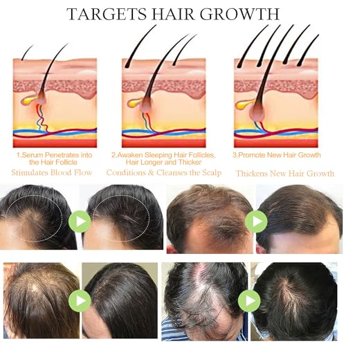 Argan oil for dandruff control - Image 7