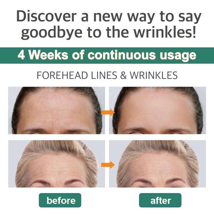 Forehead Wrinkle Reduction Patch - Image 2