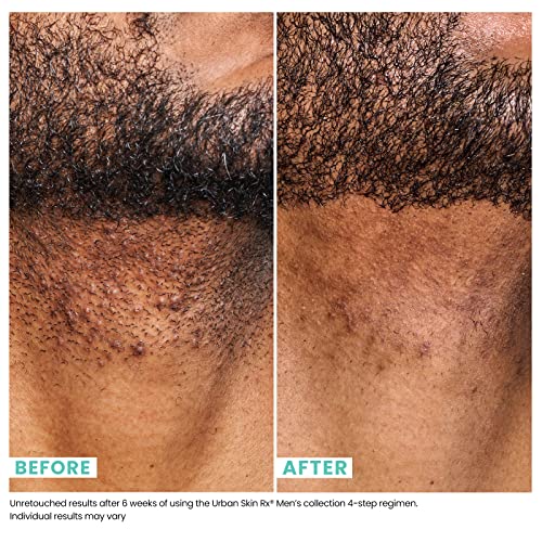 Jojoba Oil for Clogged Pores - Image 5