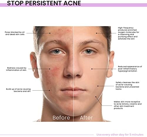 Sonic Therapy Anti Aging Face Device - Image 6