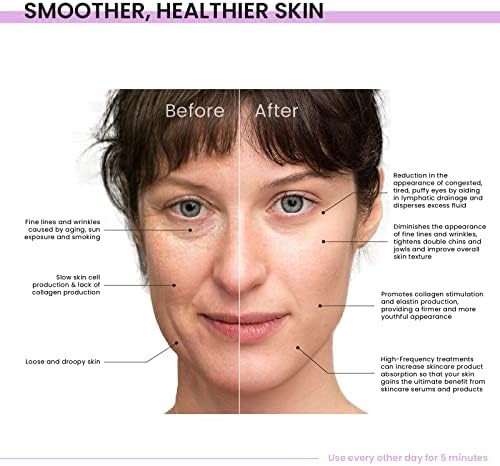 Sonic Therapy Anti Aging Face Device - Image 5