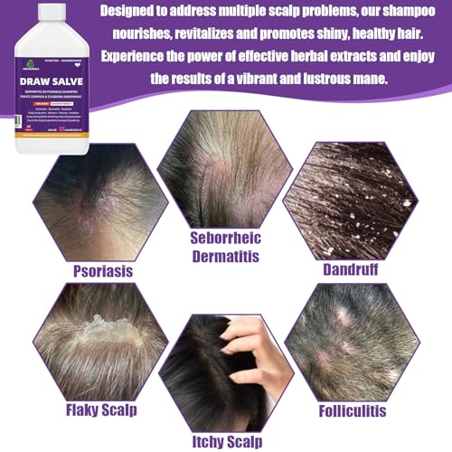 Herbal Essences Dandruff Shampoo - Image 2