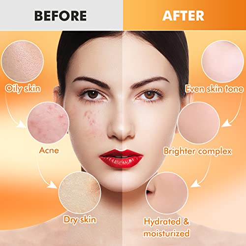 DIY Dry Skin Peel: Shorter Version - Image 6